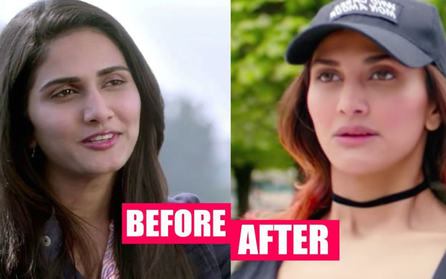 Bollywood actresses before & after plastic surgery