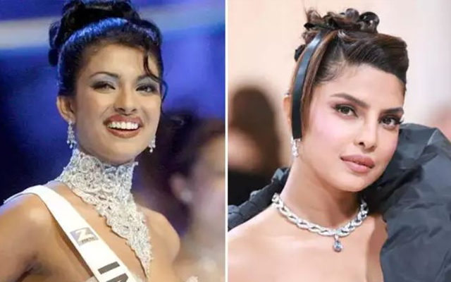 Bollywood actresses before & after plastic surgery